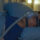 Sleep Apnea